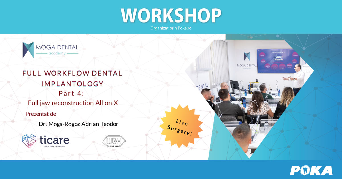 Full workflow in dental implantology - Part 4 Full jaw reconstruction All on X